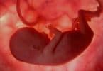 Artificial placenta